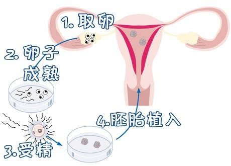 供卵代孕公司咨询